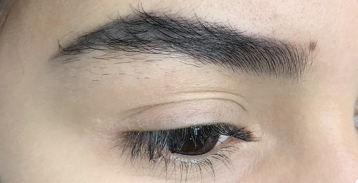 Antes: detalhe de sobrancelha com micropigmentação escura
